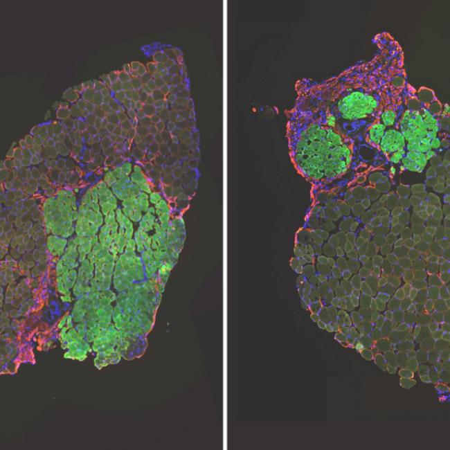 Microscopic images of regenerated mouse muscles transplanted with muscle stem cells (green) from old mice that have high levels of glutathione (left) and low levels of glutathione (right). Muscle stem cells with high glutathione levels are much more effective at contributing to new muscle tissue.