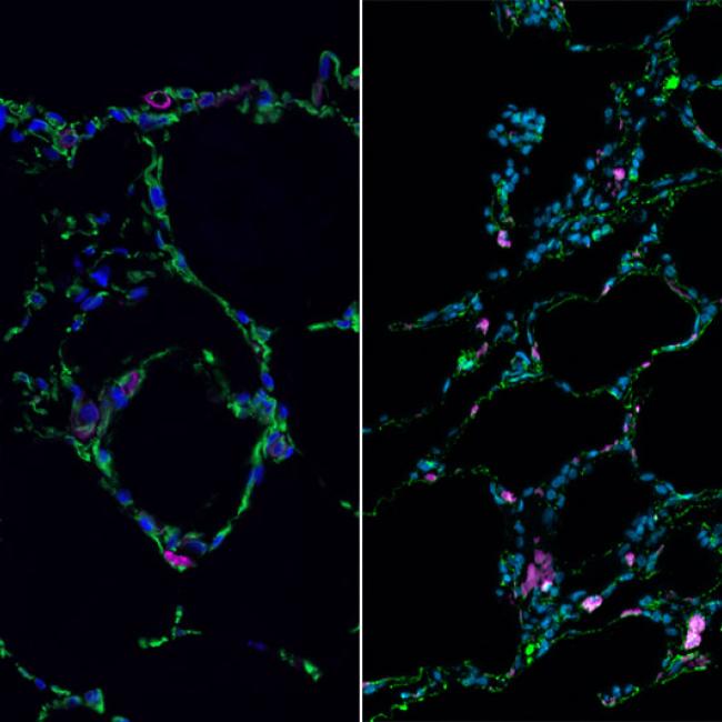 3-D bioengineered lung-like tissue (left) resembles adult human lung (right).